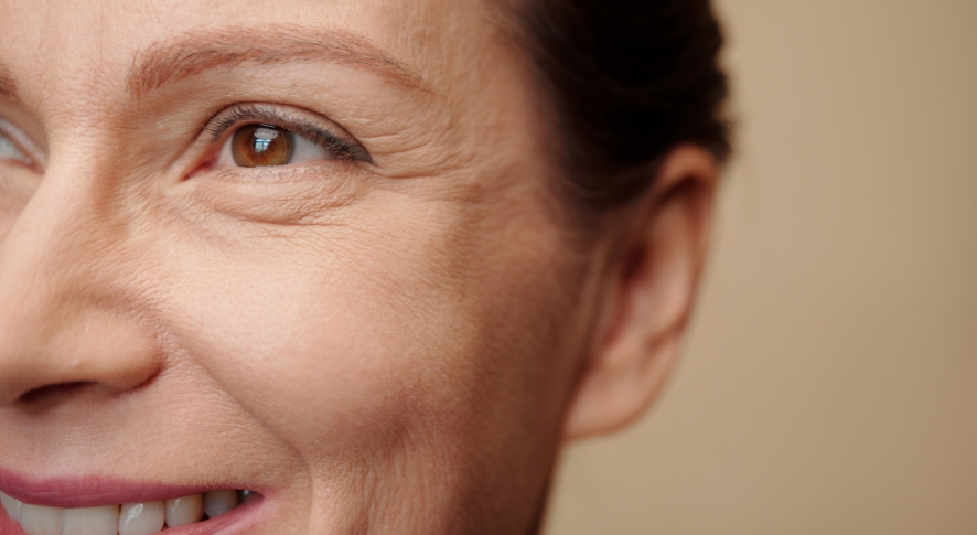Morpheus8 Under Eye Treatment: What to Expect
